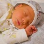 желтуха у новорожденных и ее особенности
