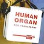 трансплантация органов детей фото
