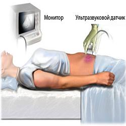 узи малого таза