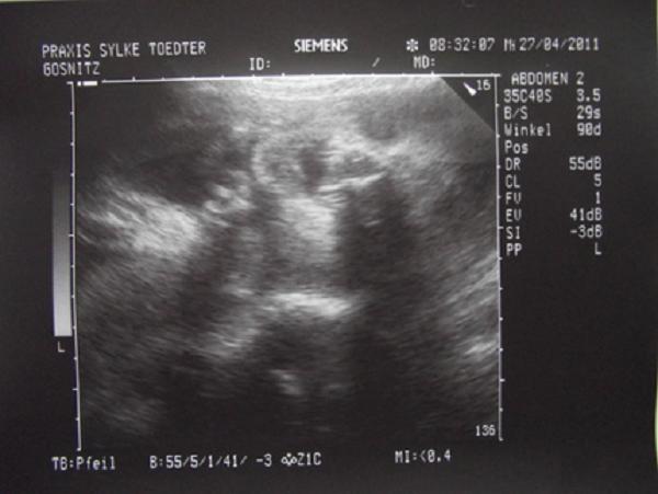 26 неделя беременности фото