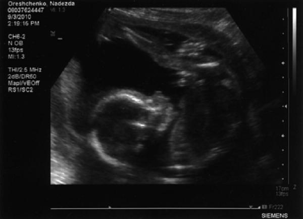 28 неделя беременности фото